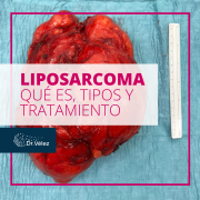 liposarcoma