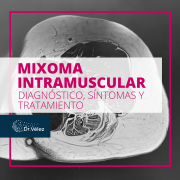 mixoma intramuscular