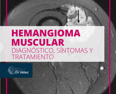 HEMANGIOMA MUSCULAR